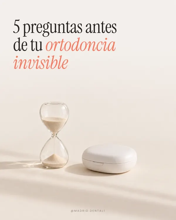 Carrusel: 5 preguntas antes de tu ortodoncia invisible