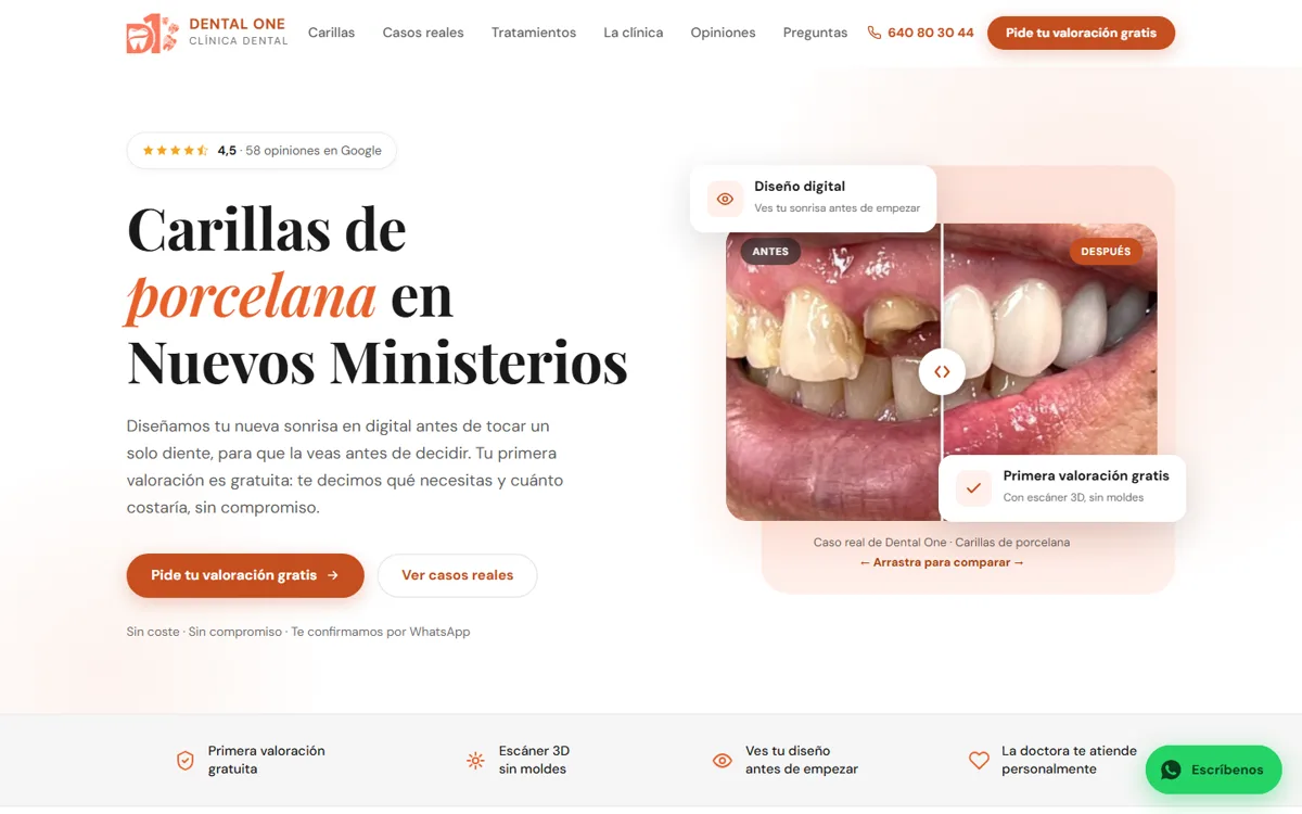 Landing de carillas de porcelana de Clínica Dental One